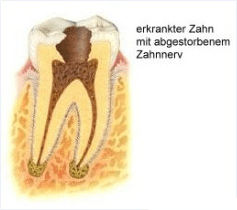 endodontie-1