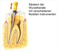 endodontie-2