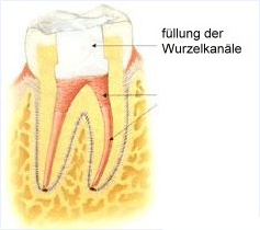 endodontie-3